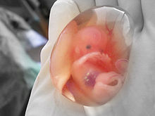 220px-Human_fetus_10_weeks_-_therapeutic_abortion