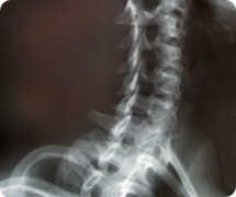 spinal_cord